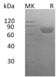 Recombinant Human SLAMF2 (C-Fc-6His)