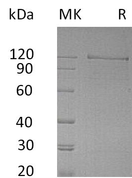 Recombinant Human NRCAM (C-Fc)