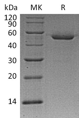 Recombinant Mouse CTSD (C-6His)