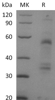 Recombinant Mouse HGF (C-6His)