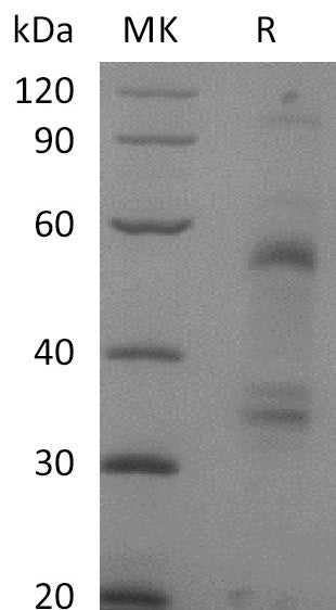 Recombinant Mouse HGF (C-6His)