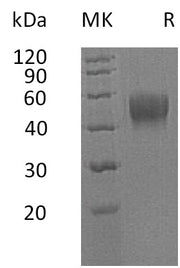 Recombinant Human IL-10RB (C-6His)