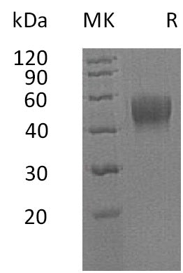 Recombinant Human IL-10RB (C-6His)