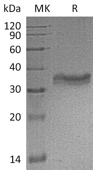 Recombinant Mouse Carbonic Anhydrase 4 (C-6His)