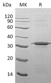 Recombinant Human ATG5