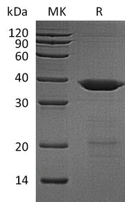 Recombinant Human UBE2K (N-6His, SUMO tag)