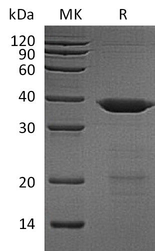 Recombinant Human UBE2K (N-6His, SUMO tag)