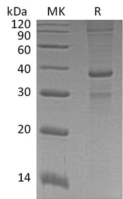 Recombinant Human ASXL1 (N-GST)