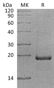 Recombinant Human EGR1 (N-6His)