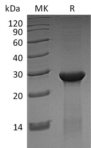Recombinant Human ASB13 (N-6His)