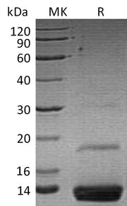 Recombinant Human Resistin (C-6His)