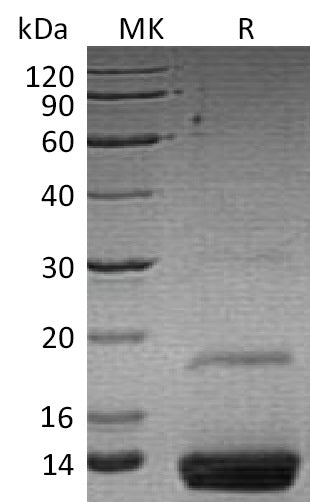 Recombinant Human Resistin (C-6His)