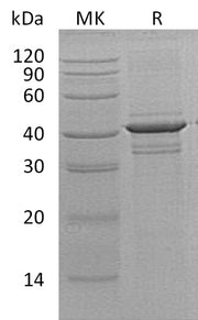Recombinant Human CRT2