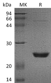 Recombinant Human UBE2M