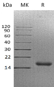 Recombinant Human CALCA (C-6His)