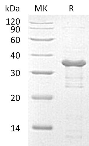Recombinant Human UBE2R2 (N-6His)