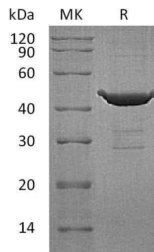 Recombinant Human RheB (N-GST)