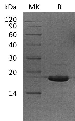 Recombinant Human UBE2V2 (N-6His)