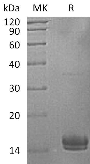 Recombinant Human UBE2V1 (C-6His)