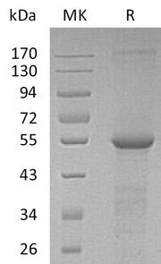 Recombinant Human TUBB4A (N-6His)