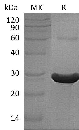 Recombinant Human TXLNA (N, C-6His)