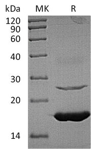 Recombinant Human UBE2L6 (C-6His)