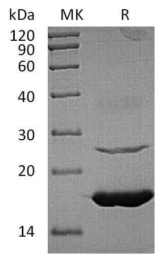 Recombinant Human UBE2L6 (C-6His)