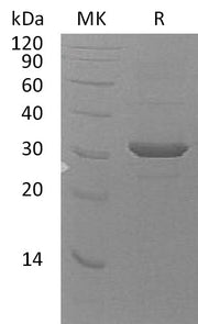 Recombinant Human UBE2Z (N-6His)