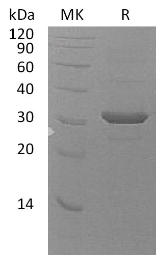 Recombinant Human UBE2Z (N-6His)