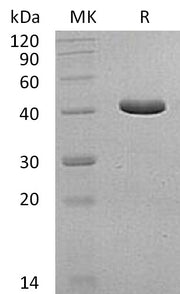 Recombinant Human GCDH (N-6His)