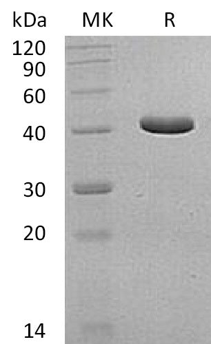 Recombinant Human GCDH (N-6His)