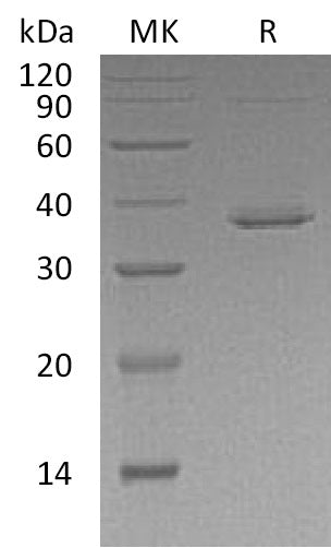 Recombinant Human STAT5B (C-6His)