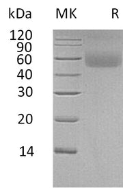 Recombinant Human LAMP (C-6His)