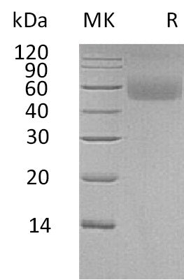 Recombinant Human LAMP (C-6His)