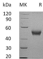 Recombinant Human B4GALT3 (C-6His)