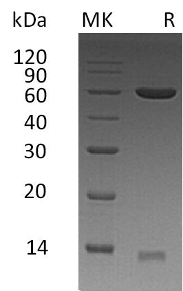 Recombinant Human PDIA3 (C-6His)