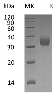 Recombinant Human CEACAM21 (C-6His)