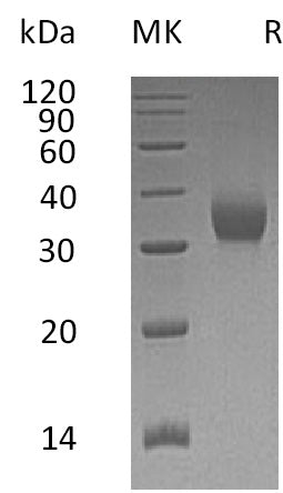 Recombinant Human CEACAM21 (C-6His)