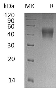Recombinant Human IL-21R (C-6His)