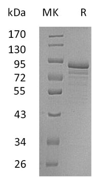 Recombinant Human CHGC (C-6His)