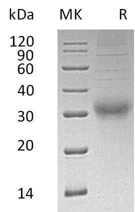 Recombinant Human CGB (C-6His)