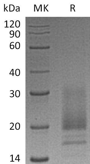 Recombinant Human VIP (C-6His)