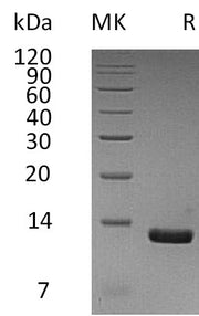 Recombinant Human CCL8 (C-6His)