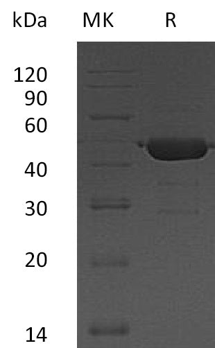 Recombinant Human UBE2G2 (N-GST)