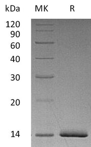 Recombinant Human ER alpha (N-6His)