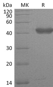 Recombinant Human GLUL (C-6His)