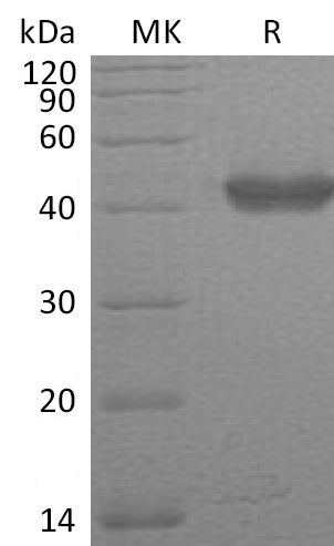Recombinant Human GLUL (C-6His)