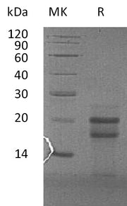 Recombinant Human PFDN4 (N-6His)