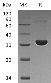 Recombinant Human PBLD (N-6His)