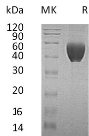 Recombinant Human FSTL1 (C-6His)